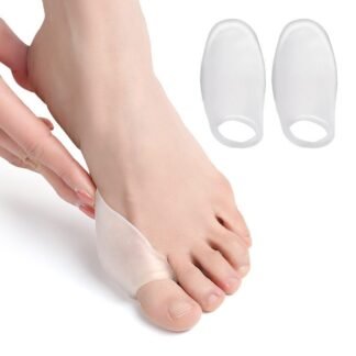 SEBS: deformidade do dedão do pé com osso lateral (joanete) – cuidados com os pés