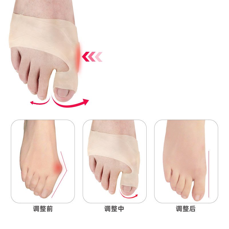 Toe care big foot bone anti-wear foot pad foot guard elastic toe device - Image 4