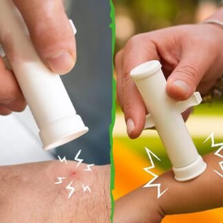 Mini bomba de sucção para alívio da coceira causada por picadas de mosquito – ferramenta portátil para uso doméstico e ao ar livre