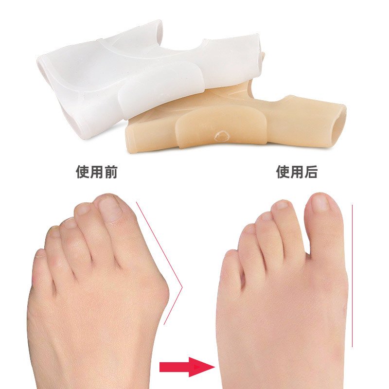 Toe care big foot bone anti-wear foot pad foot guard elastic toe device - Image 2