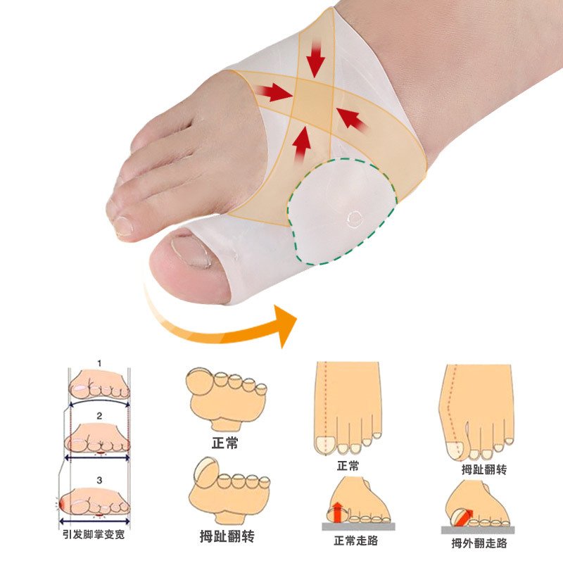 Toe care big foot bone anti-wear foot pad foot guard elastic toe device - Image 5