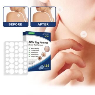 Adesivo invisível para acne, removedor de verrugas, removedor de manchas, maquiagem invisível